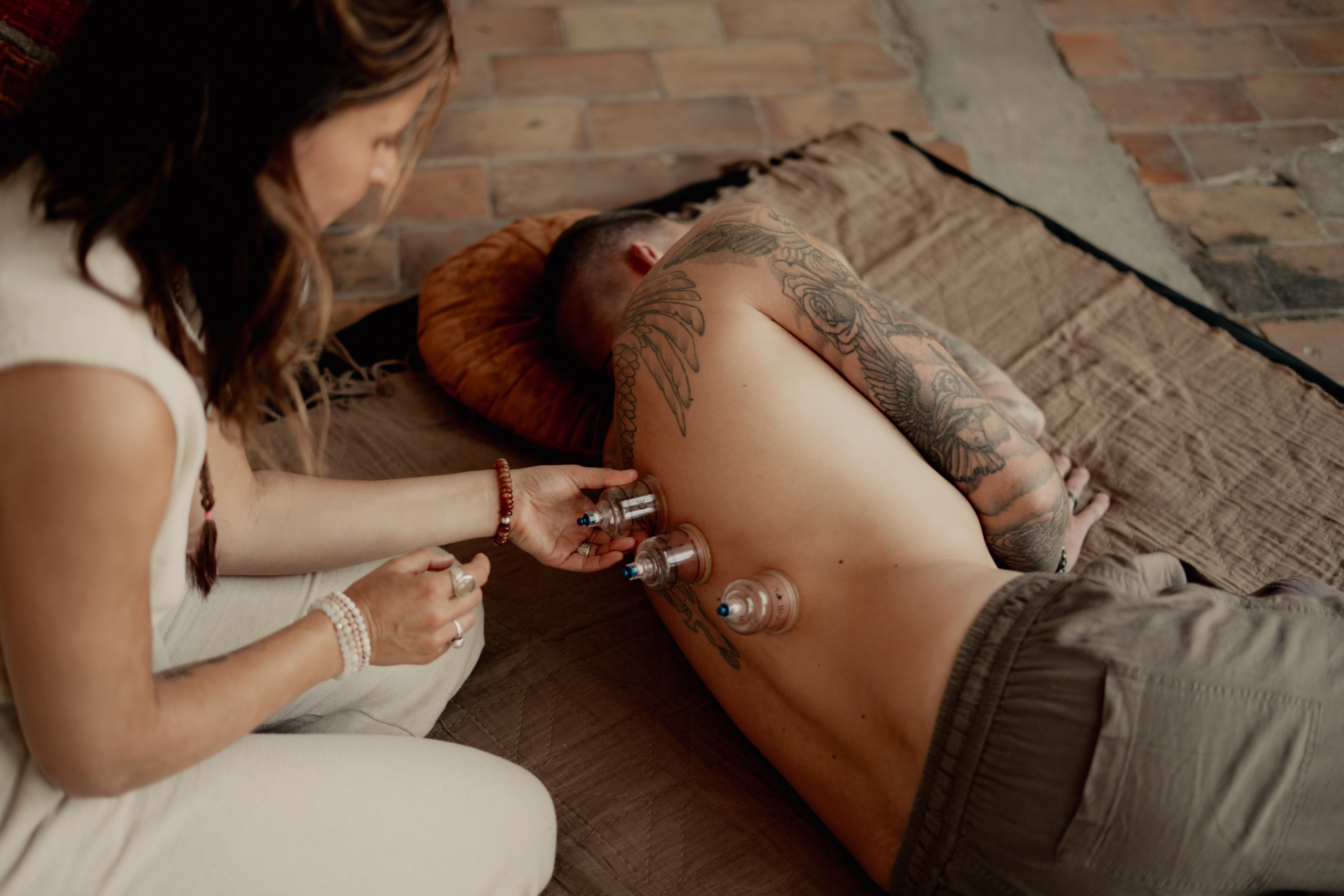 Cupping